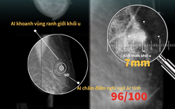 Dự báo nguy cơ tim mạch 10 năm: Bước tiến mới của y học ứng dụng AI