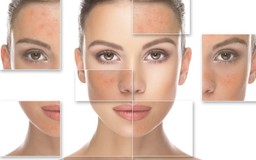 Dấu hiệu nhận biết dị ứng mỹ phẩm và cách khôi phục làn da khỏe đẹp
