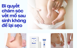 Bí quyết chăm sóc vết mổ sau sinh không để lại sẹo