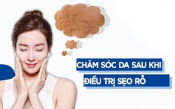 Có cần dùng thêm kem trị sẹo rỗ sau phương pháp bóc tách, laser không?