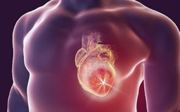 Sau cơn đau tim: 4 thay đổi về lối sống giúp giảm nguy cơ tái phát