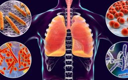 Viêm phổi tăng ở trẻ em nhiều nước: Các triệu chứng cần chú ý