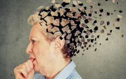 ChatGPT có thể xác định sớm người mắc bệnh Alzheimer