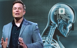 Chip não Neuralink của tỉ phú Musk khi nào mới được thử nghiệm trên người?