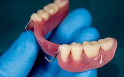 Chàng trai nhập viện vì hít bộ răng giả dài 3,8 cm vào phế quản