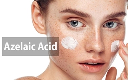 Azelaic Acid là gì? Có mang lại hiệu quả trị mụn và làm sáng da không?