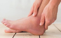 Bỗng dưng đau chân: Khi nào là dấu hiệu bệnh nguy hiểm tính mạng?