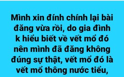 Bệnh viện vùng Tây Nguyên đề nghị xử lý vụ phát tán tin giả 'mổ cướp thận'