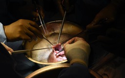 Bệnh nhân thứ 2 trên thế giới được cấy ghép tim lợn