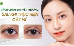 Cách chăm sóc mắt sau khi thực hiện cắt mí