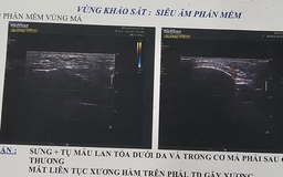 Trọng tài bị hành hung làm đơn tố giác tội phạm: ‘Lúc bị đánh vào mặt, tôi rất choáng’