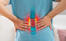 Làm sao để giảm đau cột sống thắt lưng?