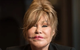 ‘Miêu nữ' Jocelyn Wildenstein gây sốc khi đăng ảnh trước và sau phẫu thuật thẩm mỹ