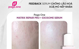 Hướng dẫn sử dụng serum chống lão hóa PageOne cho làn da căng trẻ sau 6 tuần