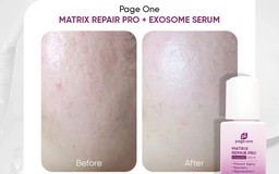 Serum chống lão hóa nào được chị em tuổi 30+ tìm mua hàng đầu hiện nay?