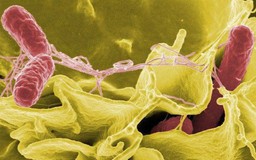Cách ngăn ngừa vi khuẩn Salmonella gây độc thực phẩm