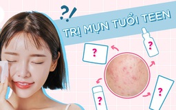 Top 10 kem trị mụn cho tuổi dậy thì hiệu quả, an toàn, không gây kích ứng