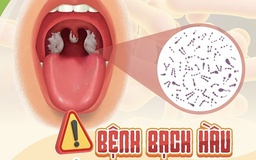 Bệnh bạch hầu: Nguồn lây không ngờ và các tình huống tiếp xúc gần