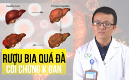 Uống rượu bia quá đà, coi chừng nguy cơ ung thư gan