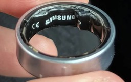 Nhập viện vì Galaxy Ring gặp sự cố pin phồng