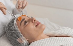 Da đỏ rát sau peel/tretinol - cơ chế phục hồi khoa học