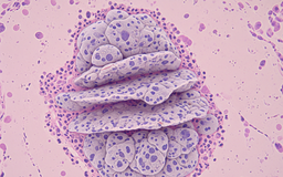 Các nhà khoa học tạo ra 'vũ khí tàng hình' tiêu diệt ung thư