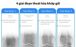 Cảnh báo: Lỡ giai đoạn vàng hồi sinh khớp gối, nhiều người gánh hệ lụy nghiêm trọng