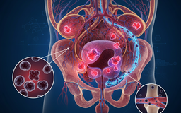 Cựu Thủ tướng Anh bị ung thư tuyến tiền liệt giai đoạn sớm, điều trị thành công