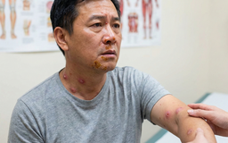 Nhóm bệnh thường gặp khi nước lũ rút