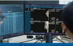 Việt Nam có sản phẩm AI chẩn đoán X-quang tuyến vú được FDA công nhận