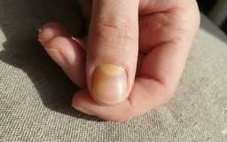 Giải mã hình bán nguyệt ở móng tay