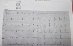 'Xuất viện rồi, không biết bệnh nhân suy tim đi đâu, về đâu?'