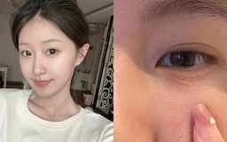 Top 3 kem retinol khiến chị em ‘giật mình’: Da mịn, căng trẻ như mới spa về!