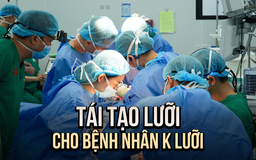 Bệnh viện tái tạo lưỡi cho bệnh nhân ung thư lưỡi