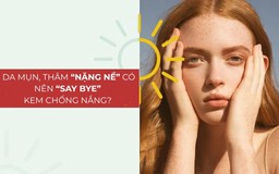 Da mụn, thâm 'nặng nề' có nên 'say bye' với kem chống nắng? 