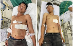 Khánh Hòa: Điều tra vụ 3 người bị đâm trọng thương