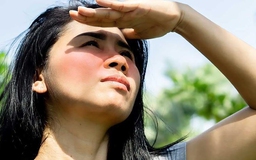 Tầm quan trọng của chống nắng đúng cách