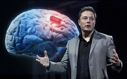 Tự chỉnh video, kể chuyện bằng... chip não Neuralink