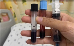 Sau khi ăn canh ghẹ, cải nấu bằng nước giếng, máu bé gái chuyển nâu đen