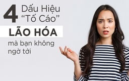 Da đẹp, không nếp nhăn vẫn lão hóa? 4 dấu hiệu ‘tố cáo’ không ngờ tới