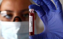 25 bang Mỹ ghi nhận ca Covid-19 tăng, xuất hiện virus khác diễn biến bất thường