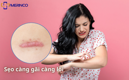 Sẹo lồi hay ngứa do đâu? Có trị hết được không?
