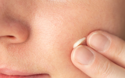 Scar Esthetique - Công thức kích hoạt làn da mới, mờ sẹo, sáng da sau mụn