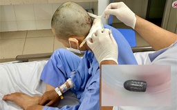 Công an làm rõ vụ người phụ nữ bị trúng đạn vào đầu khi đang làm vườn