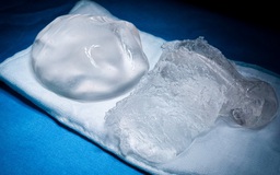 Ngực cứng sau nâng ngực là gì?