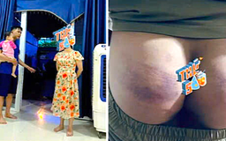 Phụ huynh tố cô đánh học sinh bầm mông trong giờ học thêm: Công an đang xác minh