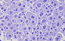 Nghiên cứu: Tìm ra cách điều trị hiệu quả ung thư gan, phổi và dạ dày