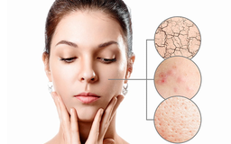 Top kem dưỡng phục hồi được ‘săn đón’ hiện nay