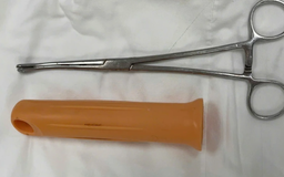 Cấp cứu nam bệnh nhân bị kẹt cán cây lau nhà trong hậu môn