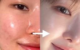 Top 7 kem dưỡng trắng da chống hóa cho tuổi 40 trẻ mãi, thời gian bỏ quên